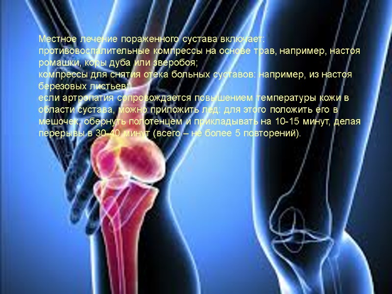 Местное лечение пораженного сустава включает: противовоспалительные компрессы на основе трав, например, настоя ромашки, коры
